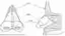 Fig. 01 - Devices, systems, and methods for manipulating nasal tissues