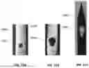 Fig. 46 - Devices, systems, and methods for manipulating nasal tissues