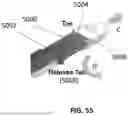 Fig. 49 - Devices, systems, and methods for manipulating nasal tissues