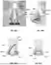 Fig. 53 - Devices, systems, and methods for manipulating nasal tissues