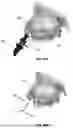 Fig. 64 - Devices, systems, and methods for manipulating nasal tissues