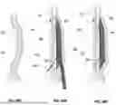 Fig. 65 - Devices, systems, and methods for manipulating nasal tissues