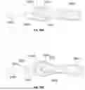Fig. 76 - Devices, systems, and methods for manipulating nasal tissues
