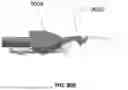 Fig. 83 - Devices, systems, and methods for manipulating nasal tissues