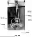 Fig. 87 - Devices, systems, and methods for manipulating nasal tissues