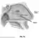 Fig. 89 - Devices, systems, and methods for manipulating nasal tissues