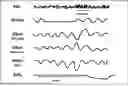 Fig. 01 - METHODS AND COMPOSITIONS FOR TREATING SLEEP APNEA