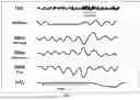Fig. 02 - METHODS AND COMPOSITIONS FOR TREATING SLEEP APNEA
