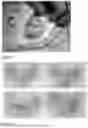 Fig. 06 - COMPOSITE DECELLULARIZED MATRIX MEMBRANE AND USE THEREOF