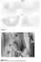 Fig. 07 - COMPOSITE DECELLULARIZED MATRIX MEMBRANE AND USE THEREOF