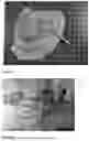 Fig. 08 - COMPOSITE DECELLULARIZED MATRIX MEMBRANE AND USE THEREOF