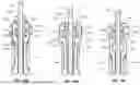 Fig. 67 - Catheter Insertion Device Including Top-Mounted Advancement Components
