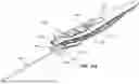 Fig. 68 - Catheter Insertion Device Including Top-Mounted Advancement Components