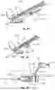 Fig. 74 - Catheter Insertion Device Including Top-Mounted Advancement Components