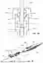 Fig. 85 - Catheter Insertion Device Including Top-Mounted Advancement Components