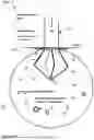 Fig. 03 - SYSTEMS AND METHODS FOR DRAINING CEREBROSPINAL FLUID