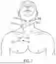 Fig. 09 - MEDICAL STIMULATOR AND METHOD OF STIMULATION