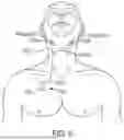 Fig. 10 - MEDICAL STIMULATOR AND METHOD OF STIMULATION
