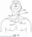 Fig. 12 - MEDICAL STIMULATOR AND METHOD OF STIMULATION