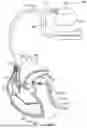 Fig. 02 - Method and system for implanting a septal wall electrode