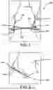 Fig. 02 - Sports Runner Device