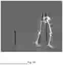 Fig. 07 - EXOSUIT DEVICE AND METHOD FOR EXOSUIT MODELING AND DESIGN