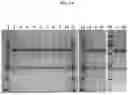 Fig. 02 - Compositions and methods comprising SFRP2 antagonists
