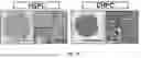 Fig. 02 - METHOD OF TREATING DISEASES USING GREMLIN1 ANTAGONISTS