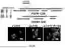Fig. 35 - METHOD OF TREATING DISEASES USING GREMLIN1 ANTAGONISTS