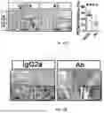 Fig. 45 - METHOD OF TREATING DISEASES USING GREMLIN1 ANTAGONISTS
