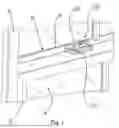 Fig. 02 - WINDOW LOCKING DEVICE AND SYSTEM