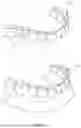 Fig. 02 - SYSTEM AND METHOD FOR MANAGEMENT AND DISTRIBUTION OF INVISIBLE DENTAL BRACES CONTAINING PRESSURE-SENSITIVE SENSORS