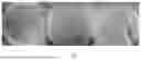 Fig. 02 - Mixed bacteria for promoting nodulation and nitrogen fixation of Robinia pseudoacacia and application thereof