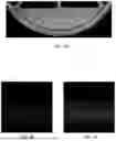 Fig. 08 - COMPUTATIONAL IN SILICO MODEL FOR CORNEA BARRIER