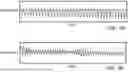 Fig. 02 - AUTOMATIC CARDIAC THERAPY ADVISOR WITH HIDDEN MARKOV MODEL PROCESSING
