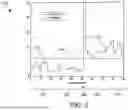 Fig. 06 - AUTOMATIC CARDIAC THERAPY ADVISOR WITH HIDDEN MARKOV MODEL PROCESSING