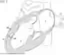 Fig. 09 - ACCESSING, IMPLANT ANCHORING, AND VISUALIZATION DURING CORONARY ARTERY BYPASS GRAFT