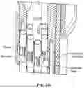Fig. 294 - PIXEL ARRAY MEDICAL SYSTEMS, DEVICES AND METHODS