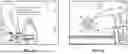 Fig. 45 - PIXEL ARRAY MEDICAL SYSTEMS, DEVICES AND METHODS