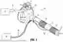 Fig. 02 - Surgical access device with active smoke filtration