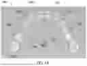Fig. 02 - TECHNIQUES FOR DETERMINING PATIENT TEETH POSITIONS FOR ORTHODONTICS