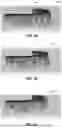 Fig. 02 - METHODS AND APPARATUSES FOR MATCHING JAWS VIRTUAL DENTAL MODEL USING TEETH REFERENCE POINTS