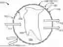 Fig. 01 - Implantable Device and Therapeutic System with Passive Oxygenation