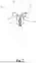 Fig. 08 - SCAPULAR ANCHOR FOR FIXING A GLENOID COMPONENT OF A SHOULDER JOINT PROSTHESIS TO A SCAPULA WITH COMPROMISED ANATOMY