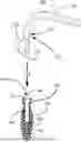 Fig. 01 - OPTIONAL SHAPED RECTOCELE PADDLES