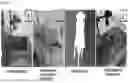 Fig. 02 - COMPOSITION CONTAINING MESENCHYMAL STEM CELL AND VASCULAR ENDOTHELIAL PROGENITOR CELL AS ACTIVE INGREDIENT FOR PREVENTION OR TREATMENT OF OCCLUSIVE VASCULAR DISEASE OR COMPLICATION THEREOF