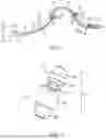 Fig. 02 - METHODS OF DELIVERING A PROSTHESIS WITH A DELIVERY CATHETER
