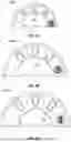 Fig. 07 - SHIELD ASSEMBLY FOR POWER TOOL