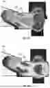 Fig. 09 - METHOD AND APPARATUS FOR ADJUSTING RECESS DEPTH OF A MOLD INSERT