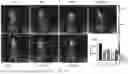 Fig. 23 - COMPOSITION AND METHOD FOR PREVENTING OR TREATING SARS-COV-2 INFECTION